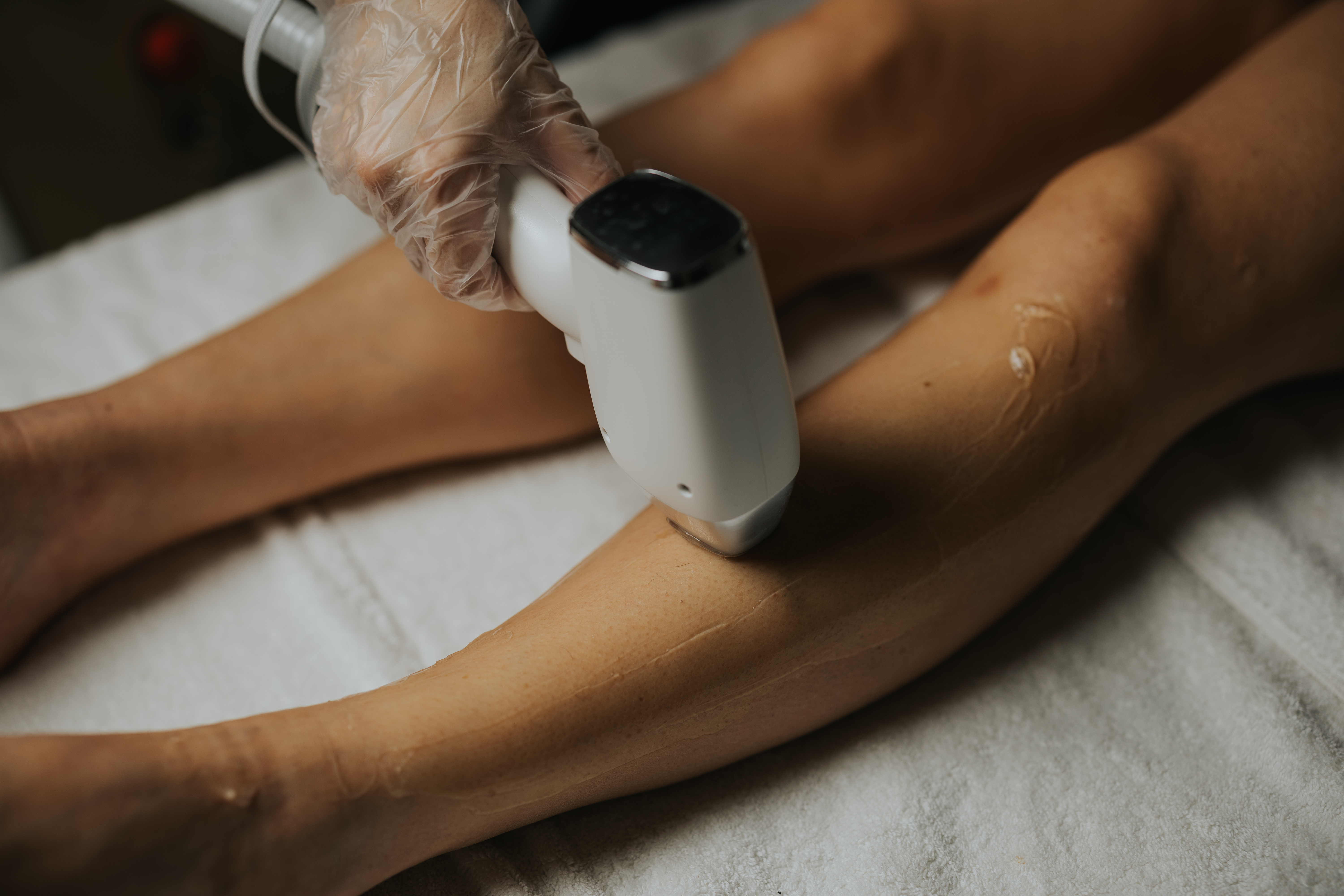 Laser Hair Removal 30Minutes