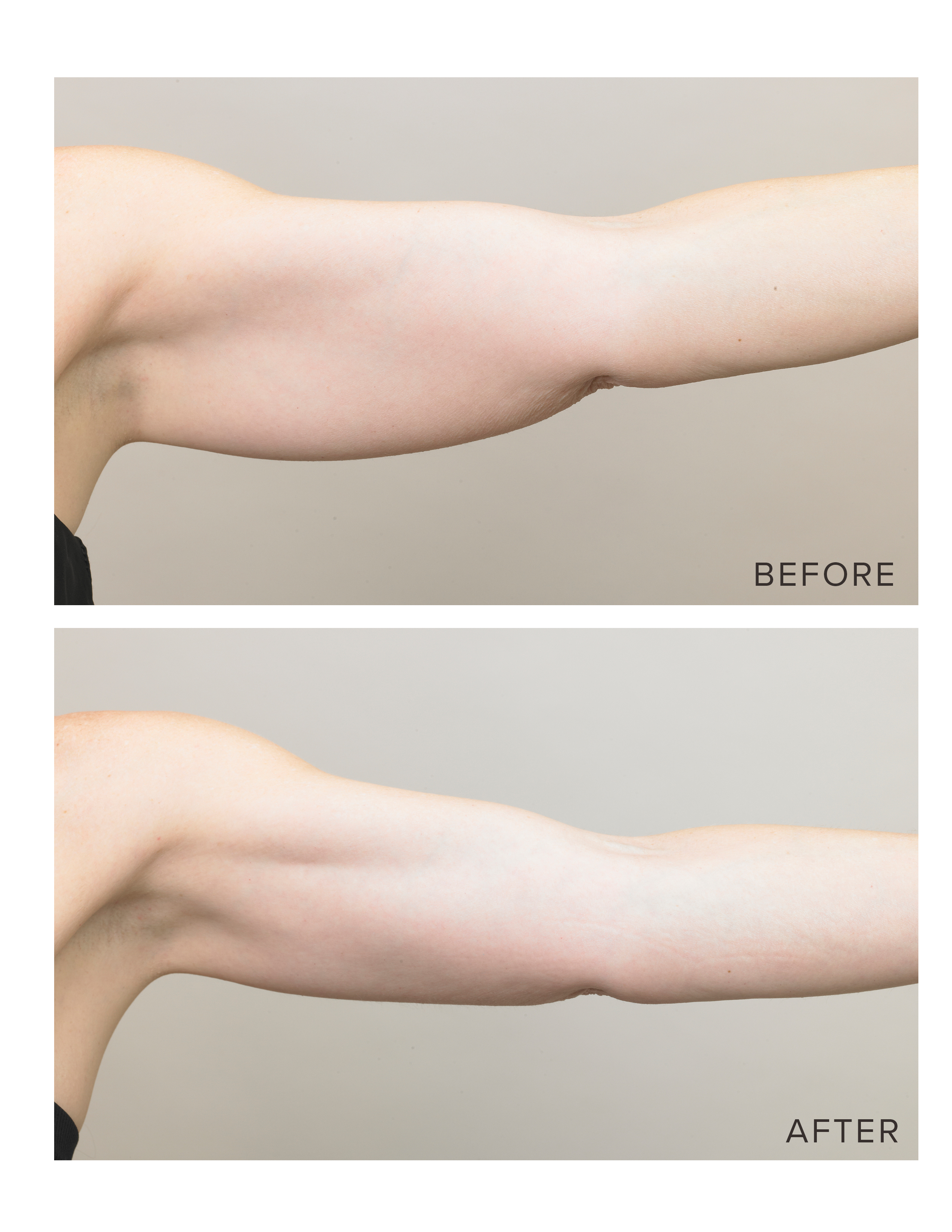 60 Minute Crepe No More De-aging Body Wrap