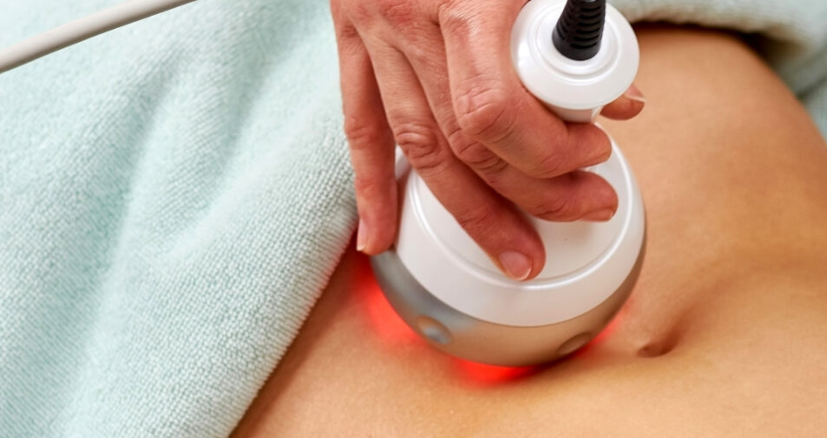 Radiofrequency- Body 